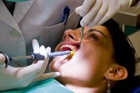 Recomendaciones después de la extracción de dientes